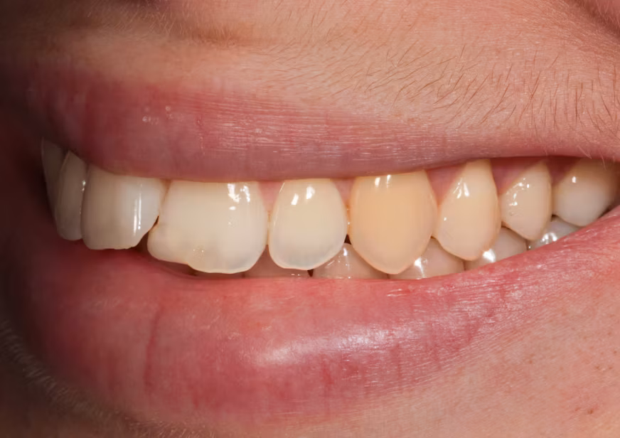 Photo of Smile Before