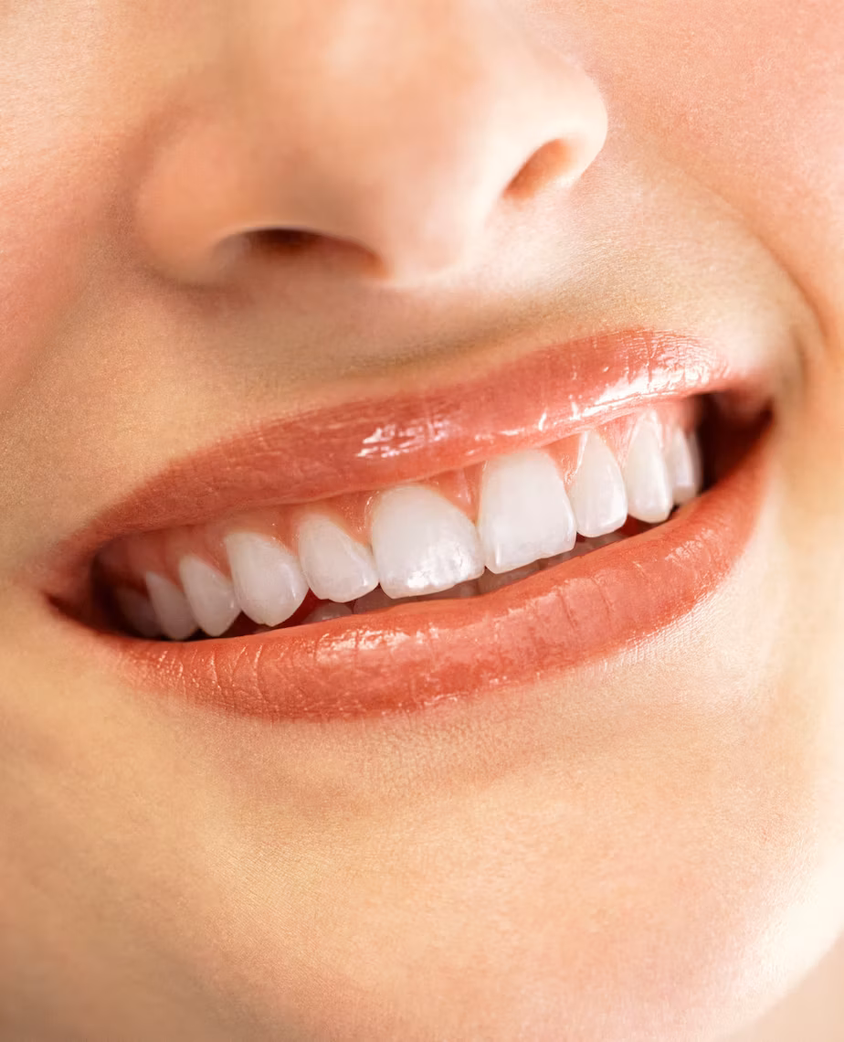 Composite Bonding